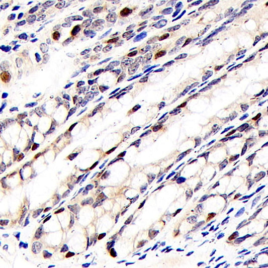 Immunohistochemistry analysis of paraffin-embedded Human hysteromyoma  using VWF Polyclonal Antibody at dilution of 1:300.