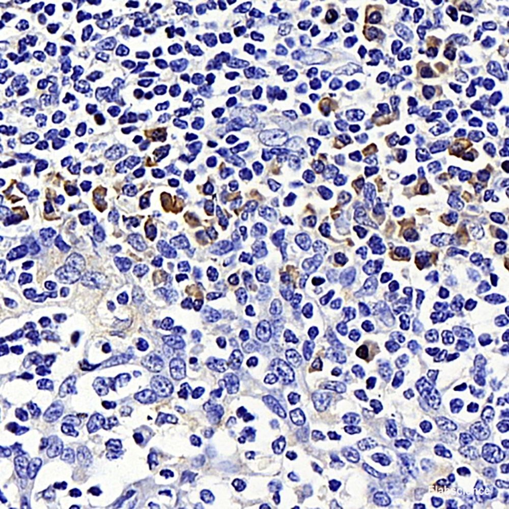 Immunohistochemistry analysis of paraffin-embedded human tonsil  using CD284 Polyclonal Antibody at dilution of 1:500.