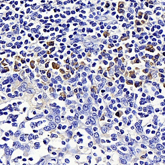 Immunohistochemistry analysis of paraffin-embedded human tonsil  using CD284 Polyclonal Antibody at dilution of 1:500.
