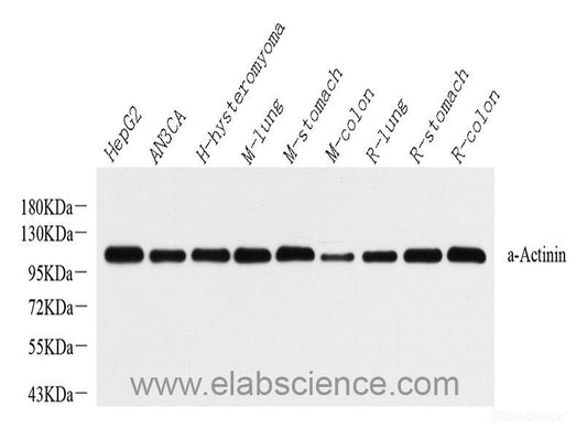 Western Blot analysis of various samples using Vimentin Polyclonal Antibody at dilution of 1:1000.