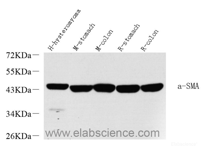 Immunohistochemistry analysis of paraffin-embedded human kidney   using COL18A1 Polyclonal Antibody at dilution of 1:400.