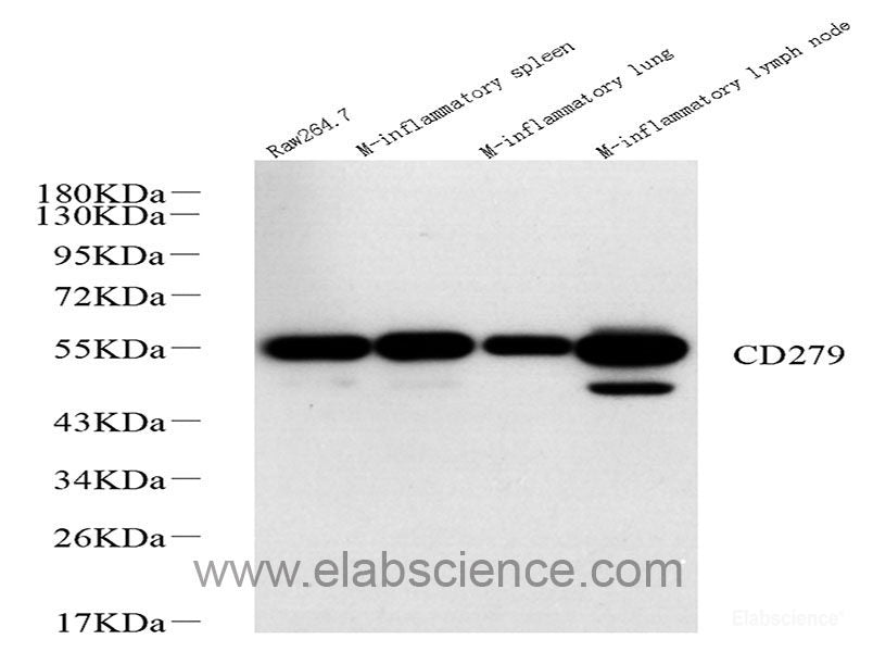 Immunohistochemistry analysis of paraffin-embedded human kidney  using PMVK Polyclonal Antibody at dilution of 1:1000.