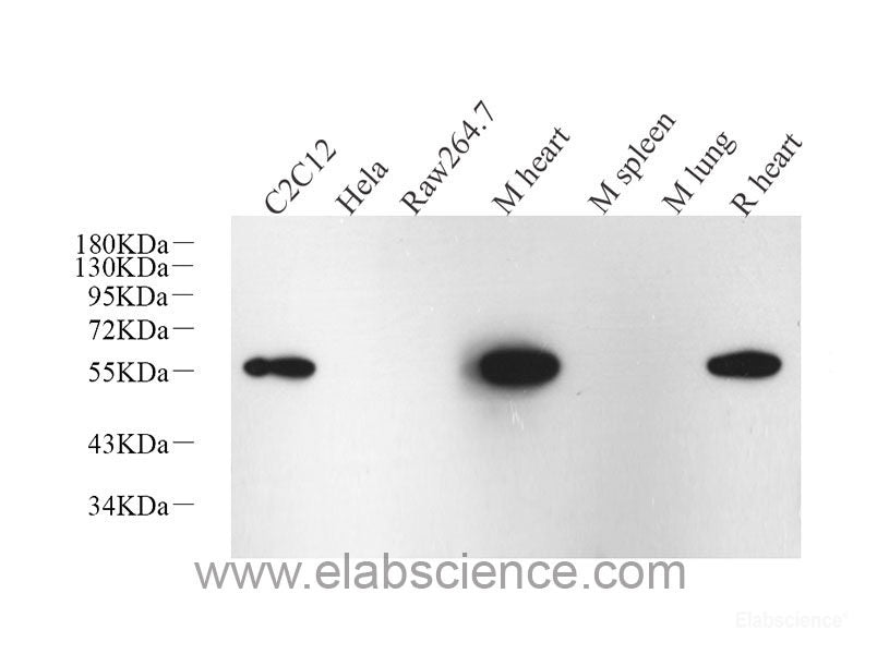 Immunohistochemistry analysis of paraffin-embedded mouse stomach  using CK-19 Monoclonal Antibody at dilution of 1:1000.