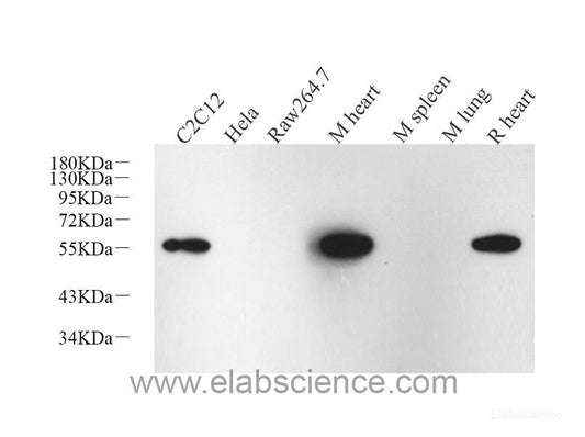 Immunohistochemistry analysis of paraffin-embedded mouse stomach  using CK-19 Monoclonal Antibody at dilution of 1:1000.