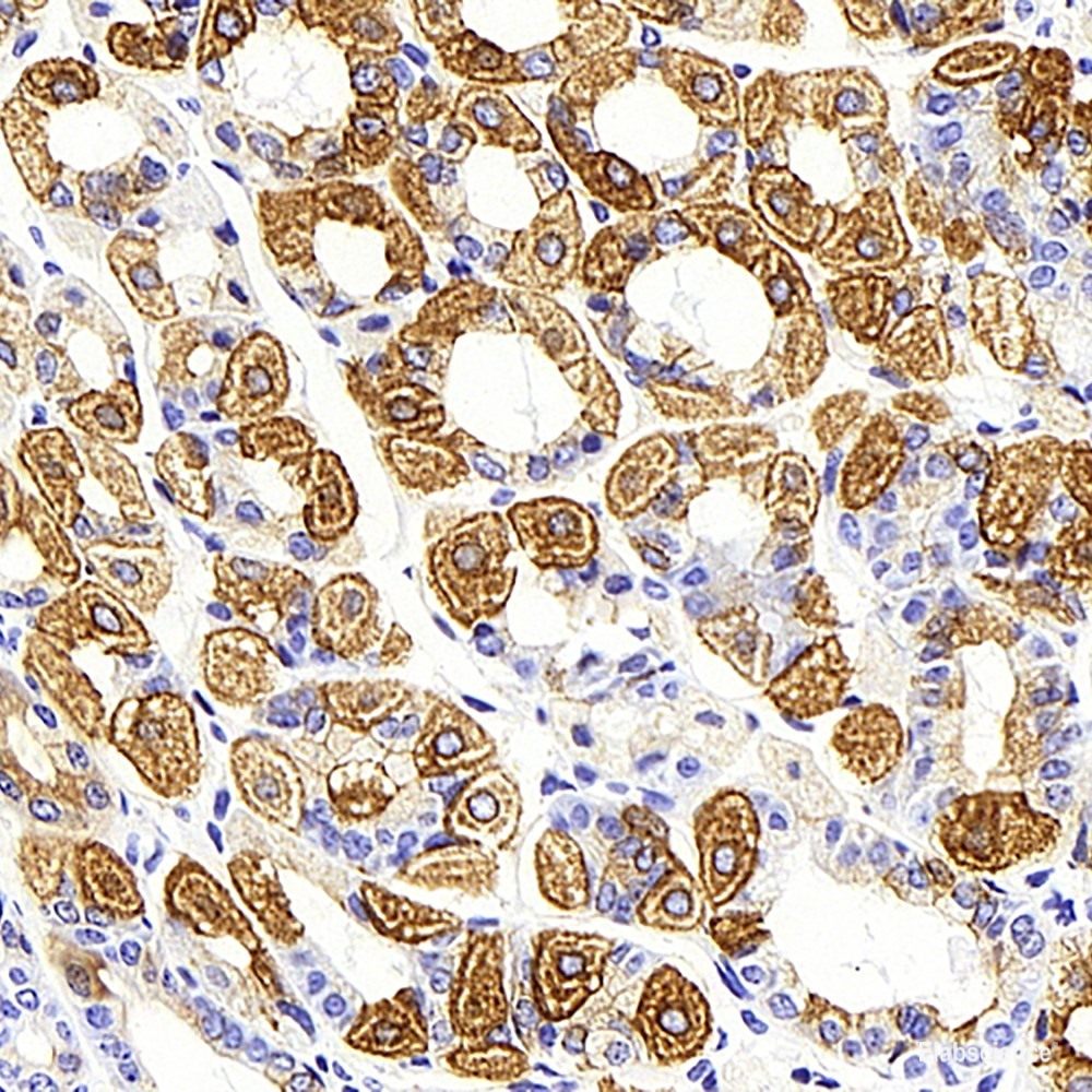 Immunohistochemistry analysis of paraffin-embedded mouse adipose tissue  using PPARG Monoclonal Antibody at dilution of 1:1000.