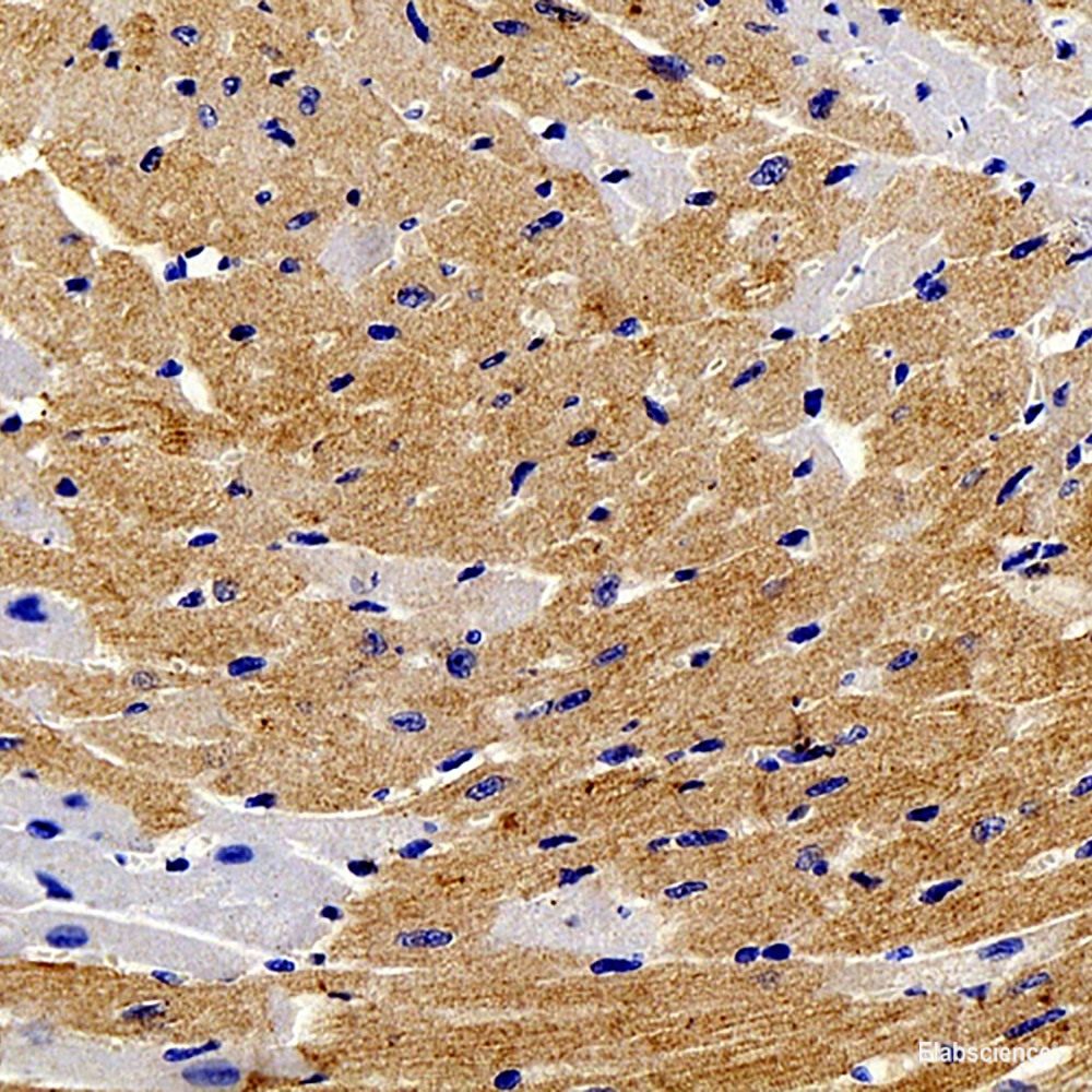 Immunohistochemistry analysis of paraffin-embedded human kidney  using JUN Polyclonal Antibody at dilution of 1:1000.
