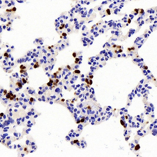 IL10 Polyclonal Antibody