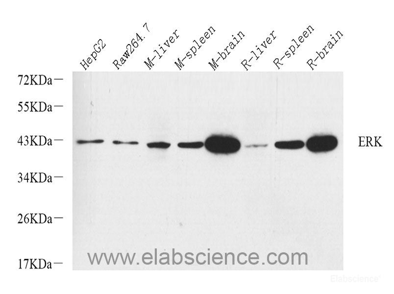 Immunohistochemistry analysis of paraffin-embedded mouse lung  using TGFB1 Polyclonal Antibody at dilution of 1:300.