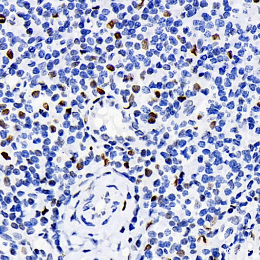 Immunohistochemistry analysis of paraffin-embedded human colon  using CHOP Polyclonal Antibody at dilution of 1:300.
