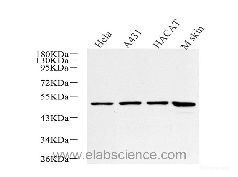 Western Blot analysis of various samples using CD14 Polyclonal Antibody at dilution of 1:1000.