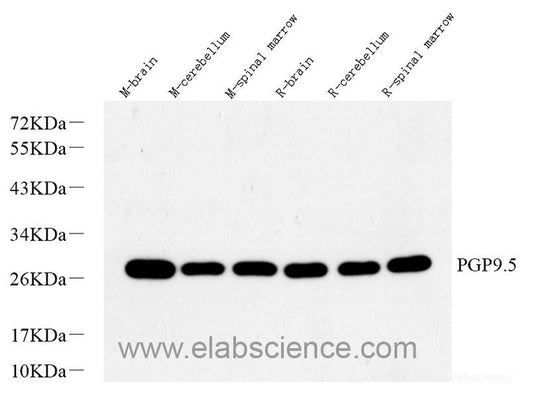 Immunohistochemistry analysis of paraffin-embedded human breast cancer  using ATG7 Polyclonal Antibody at dilution of 1:400.