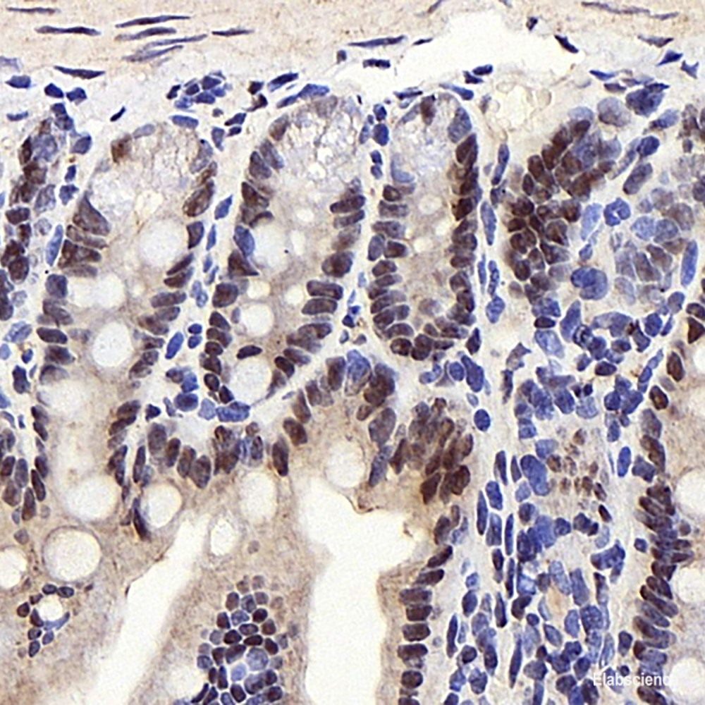 Immunohistochemistry analysis of paraffin-embedded human kidney  using DICER1 Polyclonal Antibody at dilution of 1:400.