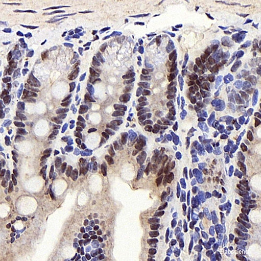 Immunohistochemistry analysis of paraffin-embedded human kidney  using DICER1 Polyclonal Antibody at dilution of 1:400.