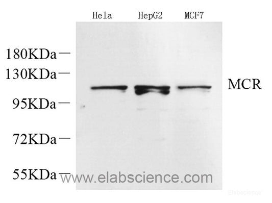 Immunohistochemistry analysis of paraffin-embedded human appendix   using FAS Polyclonal Antibody at dilution of 1:500.