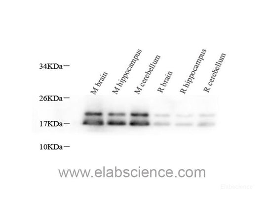 Immunohistochemistry analysis of paraffin-embedded mouse lung  using CD68 Polyclonal Antibody at dilution of 1:300.