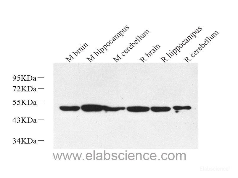 Immunofluorescence analysis of U-251 MG cells using Tau Polyclonal Antibody at dilution of  1:100 (40x lens). Blue: DAPI for nuclear staining.
