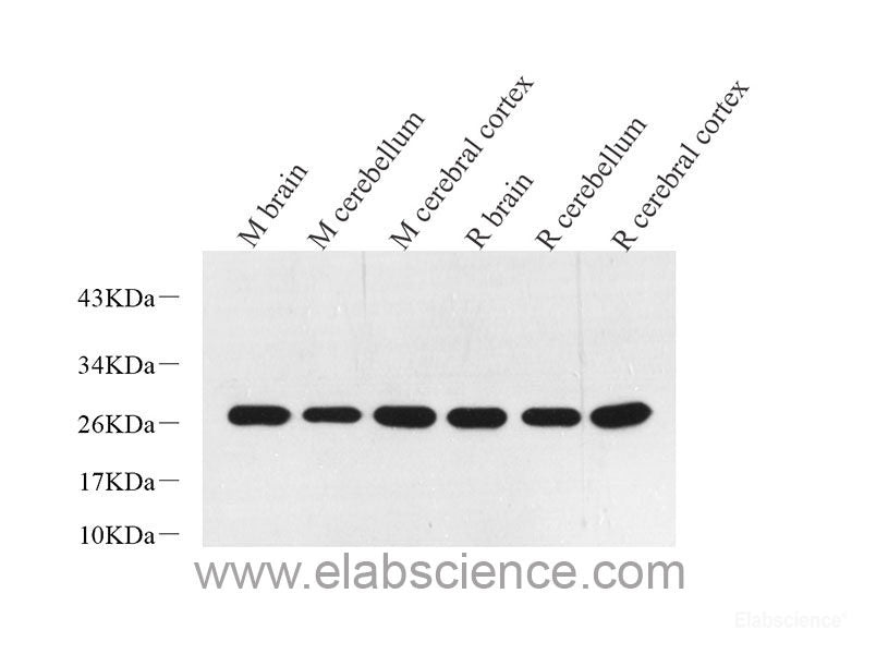 Immunofluorescence analysis of Y79 cells using Rb Polyclonal Antibody at dilution of  1:100 (40x lens). Blue: DAPI for nuclear staining.