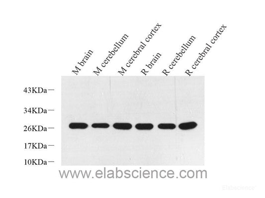Immunofluorescence analysis of Y79 cells using Rb Polyclonal Antibody at dilution of  1:100 (40x lens). Blue: DAPI for nuclear staining.