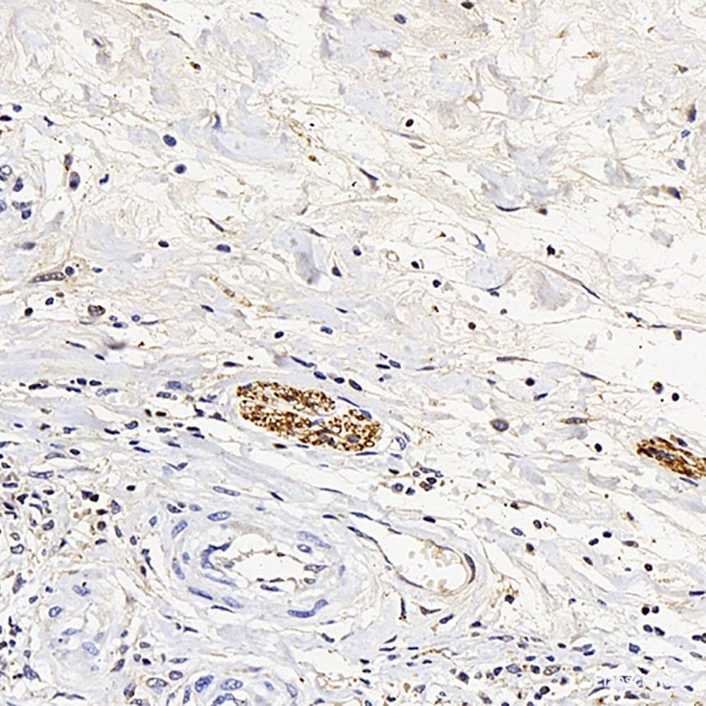 Immunofluorescence analysis of RAW264.7 cells using TLR4 Polyclonal Antibody at dilution of  1:100 (40x lens). Blue: DAPI for nuclear staining.