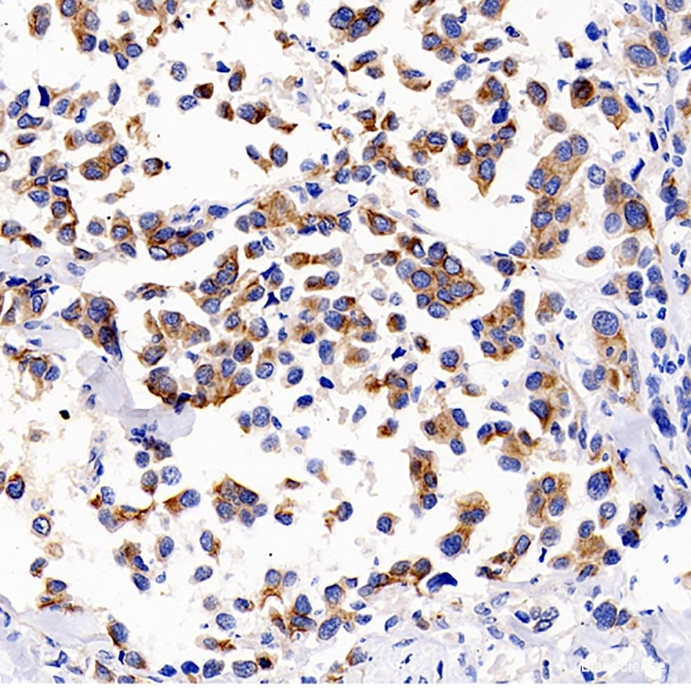Immunohistochemistry of paraffin-embedded Rat brain using STAT1 Polyclonal Antibody at dilution of  1:100 (40x lens).