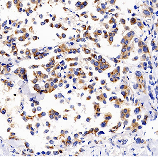 Immunohistochemistry of paraffin-embedded Rat brain using STAT1 Polyclonal Antibody at dilution of  1:100 (40x lens).