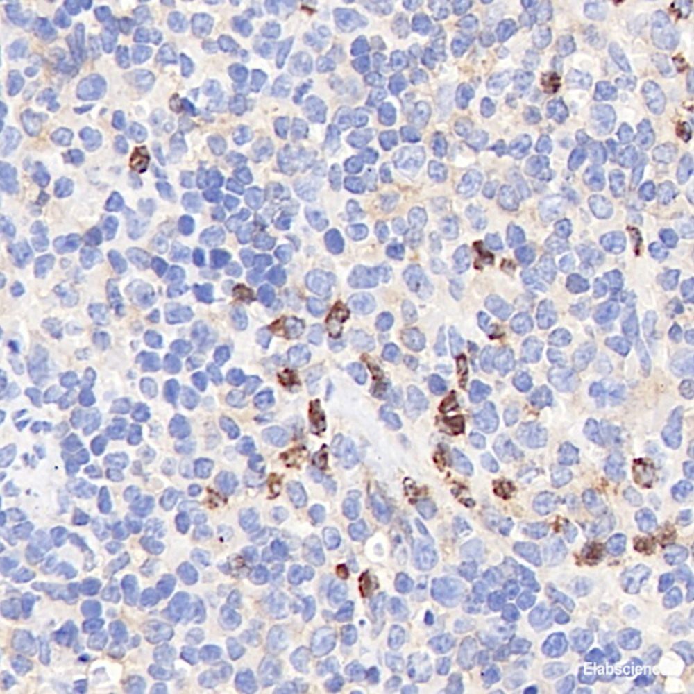 Immunohistochemistry of paraffin-embedded Rat brain using TH Polyclonal Antibody at dilution of  1:100 (40x lens).