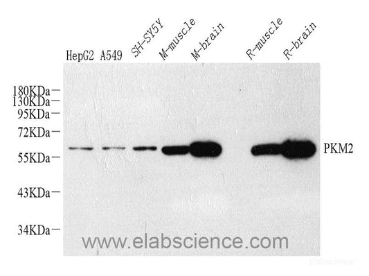 Immunofluorescence analysis of HeLa cells using TNFRSF1A Polyclonal Antibody