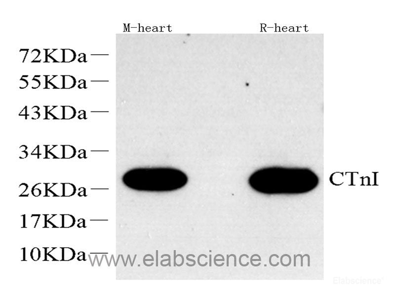 Immunohistochemistry of paraffin-embedded Rat brain using PI3 Kinase p85 alpha Polyclonal Antibody at dilution of  1:100 (40x lens).