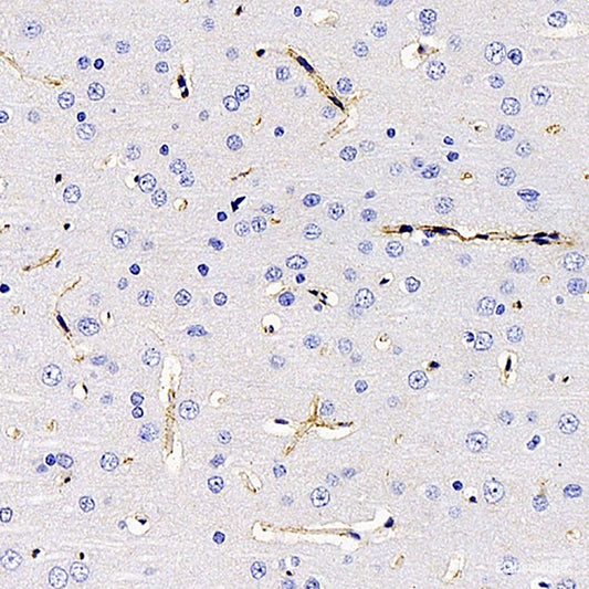 Immunohistochemistry of paraffin-embedded Rat heart using CAST Polyclonal Antibody at dilution of  1:100 (40x lens).
