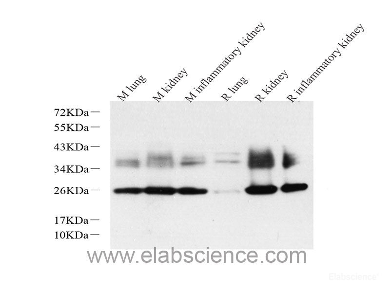 Immunohistochemistry of paraffin-embedded Rat brain using FoxO3a Polyclonal Antibody at dilution of  1:100 (40x lens).