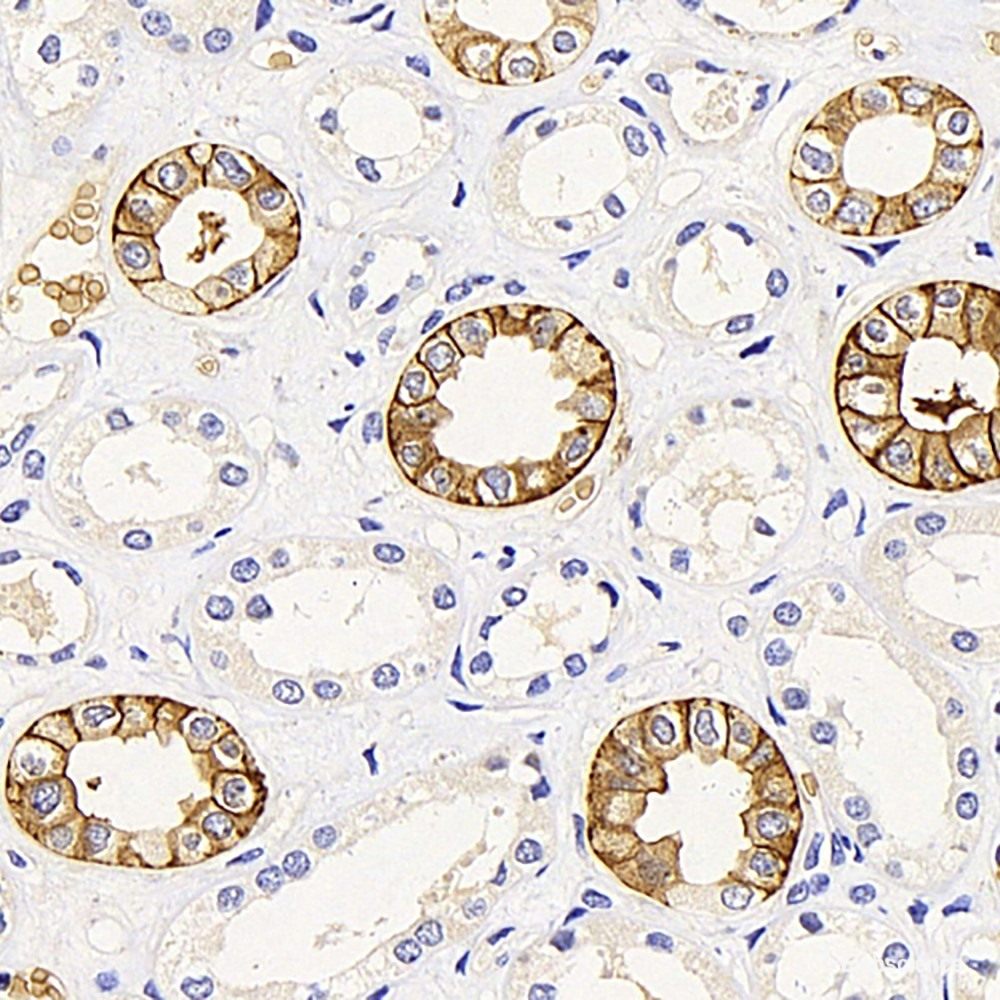 Immunofluorescence analysis of Rat brain using GRIA2 Polyclonal Antibody at dilution of  1:50. Blue: DAPI for nuclear staining.