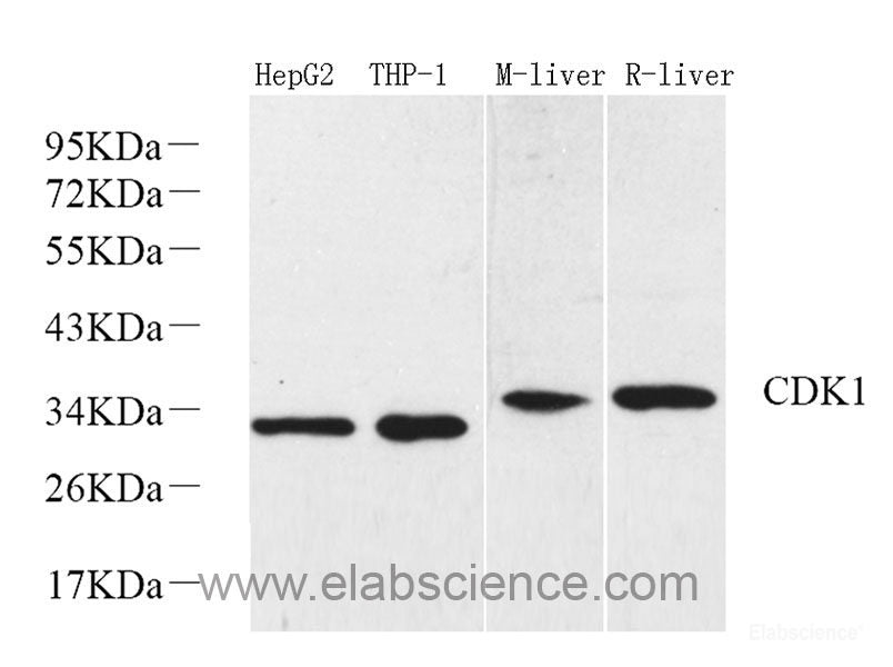 Immunohistochemistry of paraffin-embedded Human stomach using HDAC4 Polyclonal Antibody at dilution of  1:100 (40x lens).