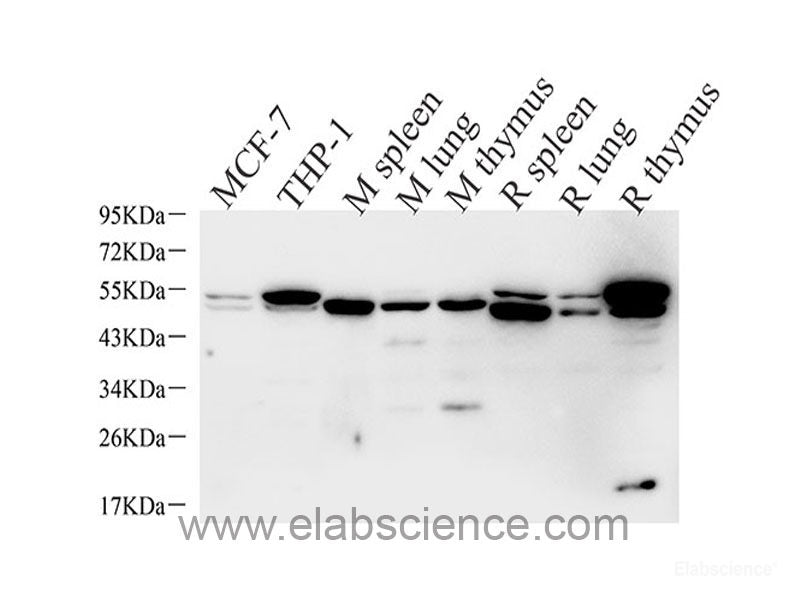Immunohistochemistry of paraffin-embedded Mouse brain using BRCA1 Polyclonal Antibody at dilution of  1:100 (40x lens).