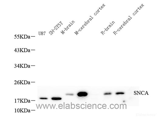 Western blot analysis of extracts of various cell lines using Caspase-8 Polyclonal Antibody at dilution of 1:1000.