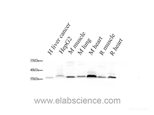 Western blot analysis of extracts of various cell lines using FABP4 Polyclonal Antibody.