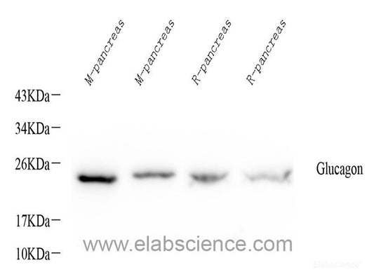Immunohistochemistry of paraffin-embedded Rat brain using GRP78 / BiP Polyclonal Antibody at dilution of  1:100 (40x lens).