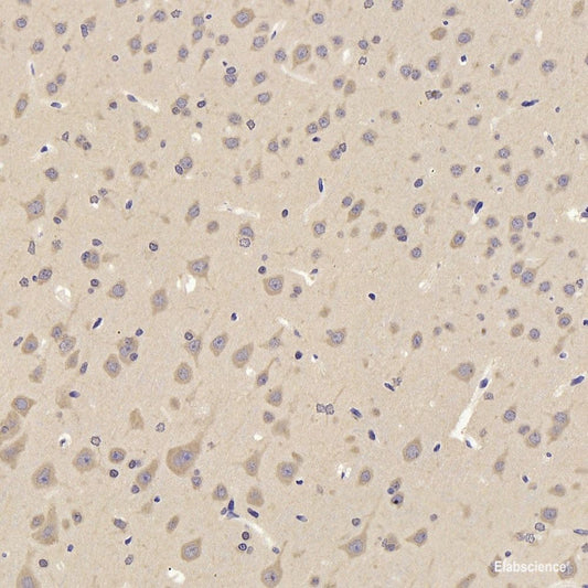Immunohistochemistry of paraffin-embedded Mouse liver using IGF1R Polyclonal Antibody at dilution of  1:100 (40x lens).