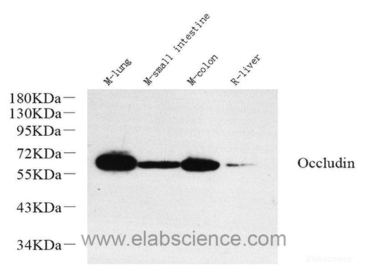 Western blot analysis of extracts of various cell lines using IKBKE Polyclonal Antibody.