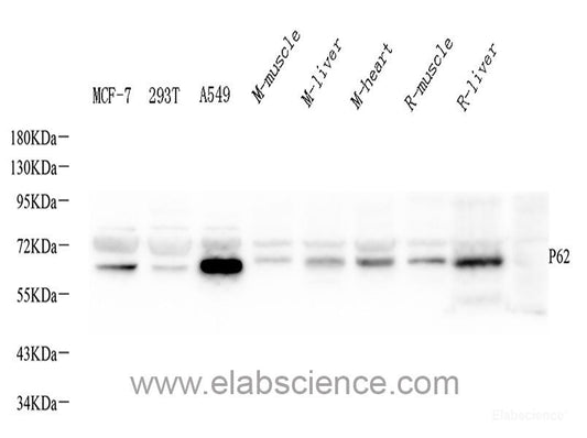 Western blot analysis of extracts of various cell lines using Lamin A/C Polyclonal Antibody at dilution of 1:1000. HeLa cells were treated by Hydroxyurea (4 mM) at 37°C for 20 hours or treated by Paclitaxel (100 nM/ml) at 37°C for 20 hours. C6 cells were treated by Hydroxyurea (4 mM) at 37°C for 20 hours or treated by Paclitaxel (100 nM) at 37°C for 20 hours.