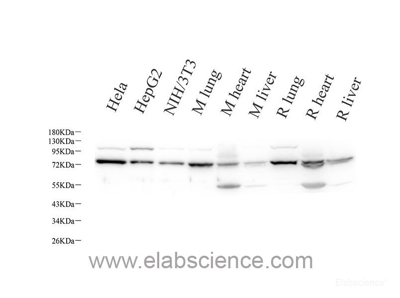 Immunohistochemistry of paraffin-embedded Human lung cancer using MCL1 Polyclonal Antibody at dilution of  1:100 (40x lens).