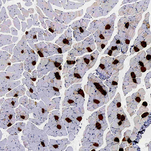 Western blot analysis of extracts of Mouse brain using MAP2K2 Polyclonal Antibody.