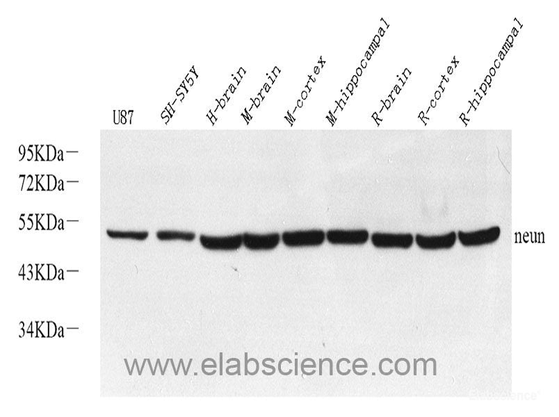 Immunohistochemistry of paraffin-embedded Rat heart using NME1 Polyclonal Antibody at dilution of  1:200 (40x lens).