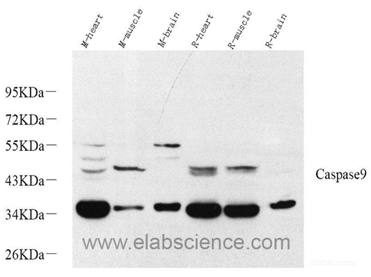 Western blot analysis of extracts of various cell lines using NUDT6 Polyclonal Antibody at dilution of 1:1000.