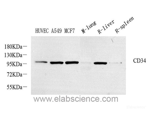 Western blot analysis of extracts of various cell lines using p53 Polyclonal Antibody at dilution of 1:1000.