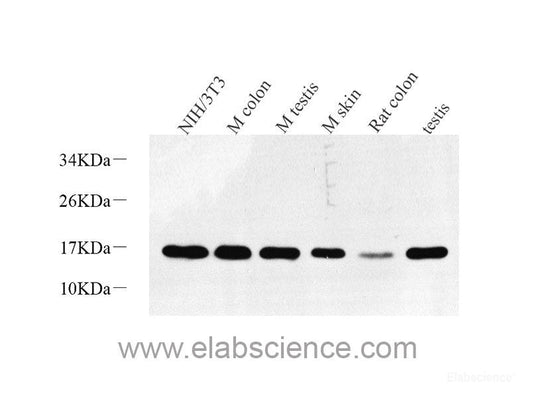 Western blot analysis of extracts of various cell lines using PCNA Polyclonal Antibody at dilution of 1:1000.