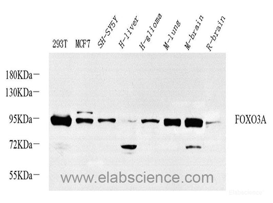 Western blot analysis of extracts of various cell lines using PRKCA Polyclonal Antibody.
