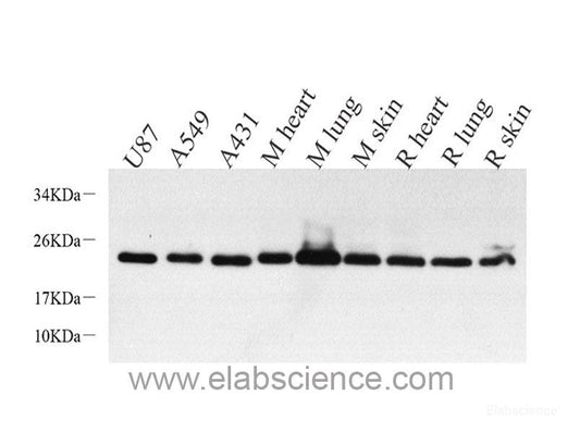 Immunohistochemistry of paraffin-embedded Rat ovary using SIRT2 Polyclonal Antibody at dilution of  1:100 (40x lens).