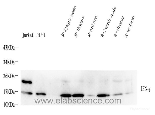 Western blot analysis of extracts of HeLa cells using ABL1 Polyclonal Antibody at dilution of 1:1000.