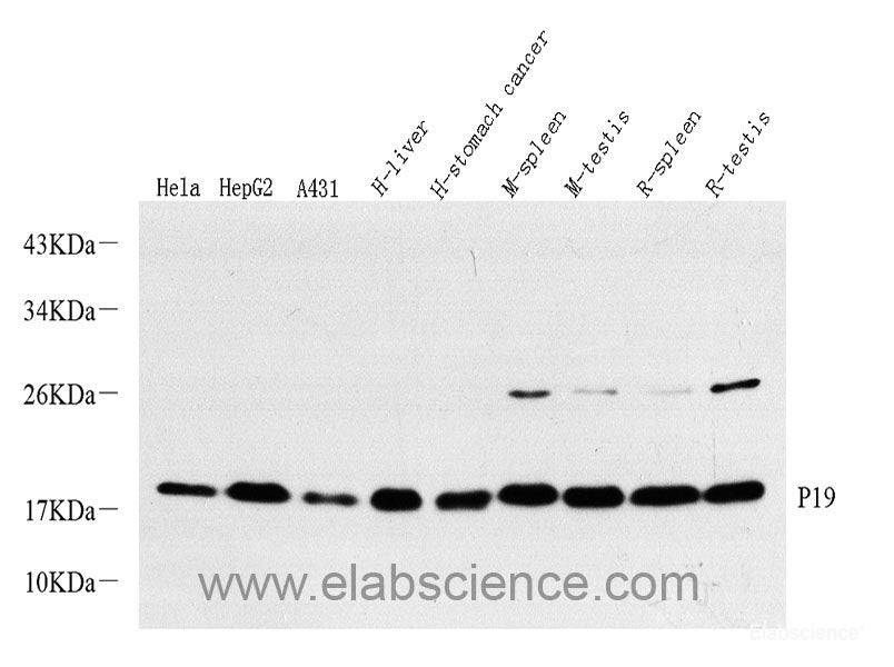 Immunohistochemistry of paraffin-embedded Rat brain using CDKN1B Polyclonal Antibody at dilution of  1:200 (40x lens).