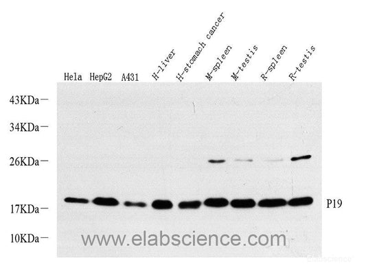 Immunohistochemistry of paraffin-embedded Rat brain using CDKN1B Polyclonal Antibody at dilution of  1:200 (40x lens).